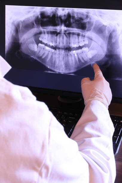 Best Emergency Treatment for Dental Infections or Abscesses in Wytheville, VA