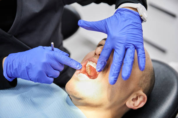Best Emergency Dental Care for Broken or Chipped Teeth in Wytheville, VA